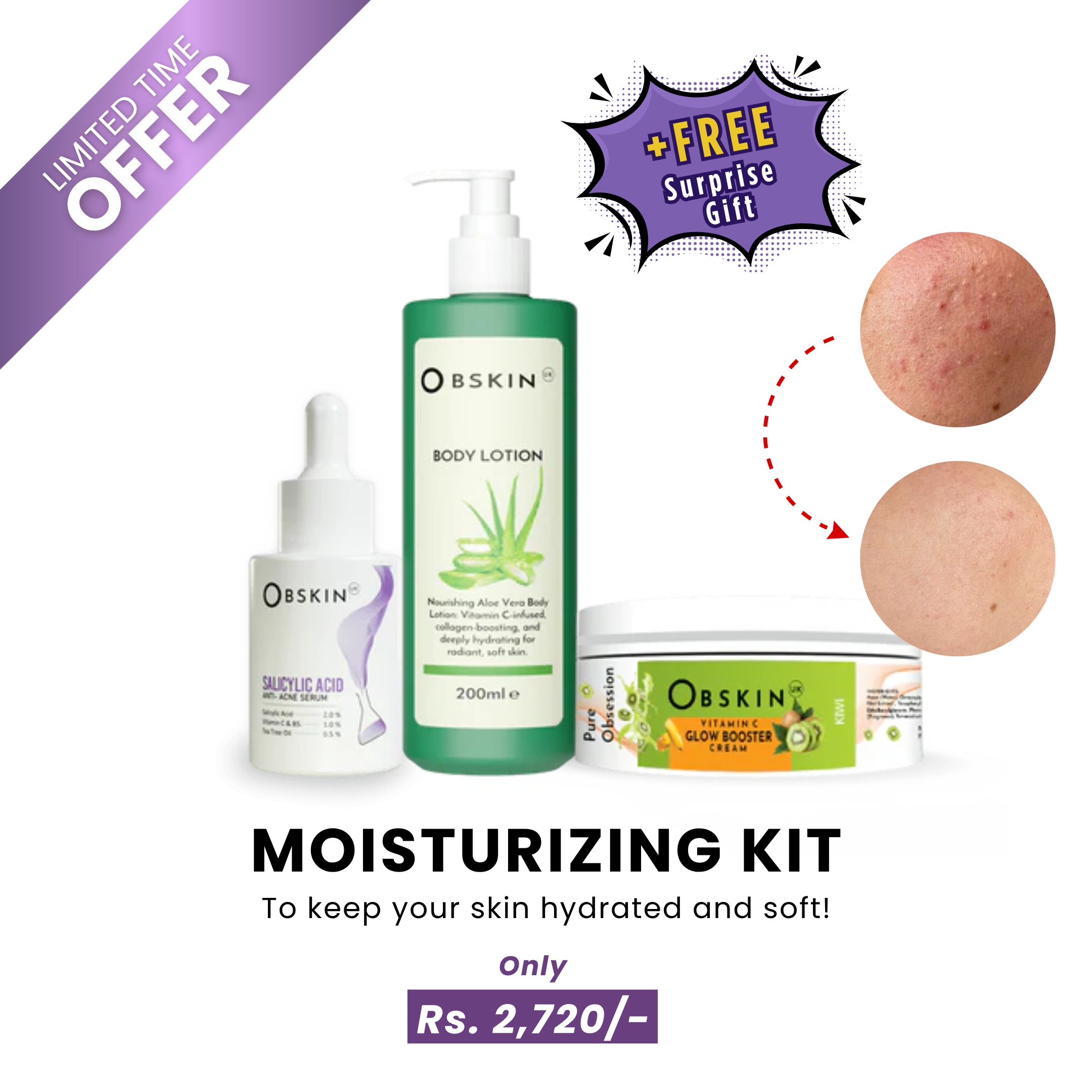 Moisturising Kit with Free Gift